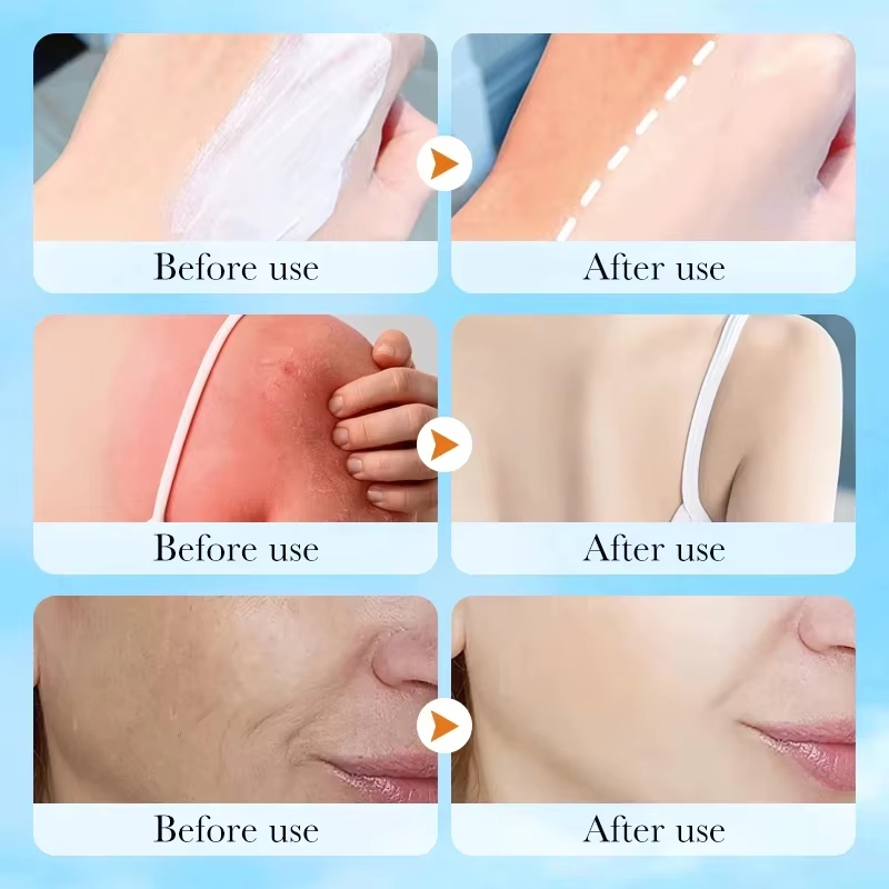 Korean SKIN1004 Centella Air-F - Skincare Skin 1004 review and price